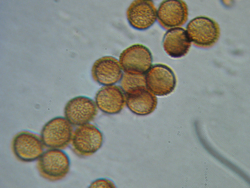 Metatrichia vesparium?